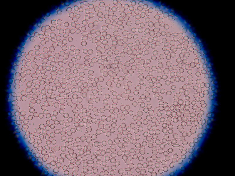 image of blood cells under a microscope