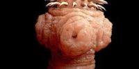 natural parasite detox